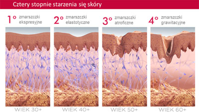 Cztery stopnie starzenia się skóry