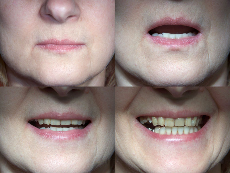 Dental treament planning