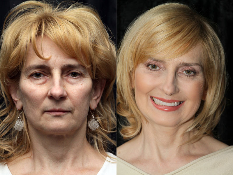 Małgorzata Strzałkowska - aged 58