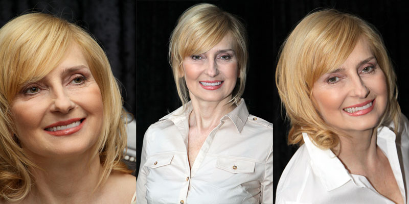 Małgorzata after the makeover treatment at UNIDENT UNION DENTAL SPA Clinic