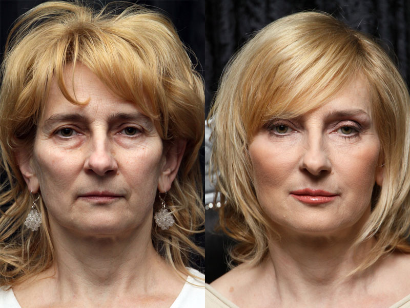 Małgorzata before and after the makeover treatment